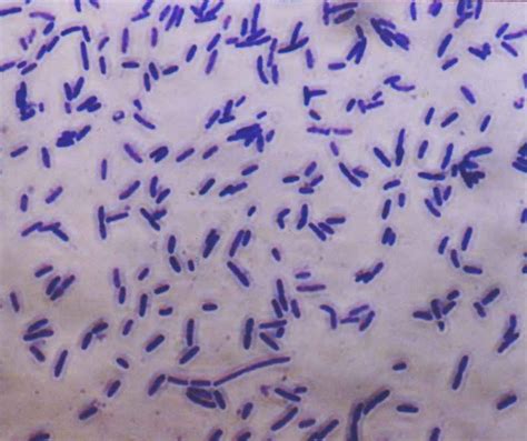 Pathogenic Bacteria - Key Stage Wiki