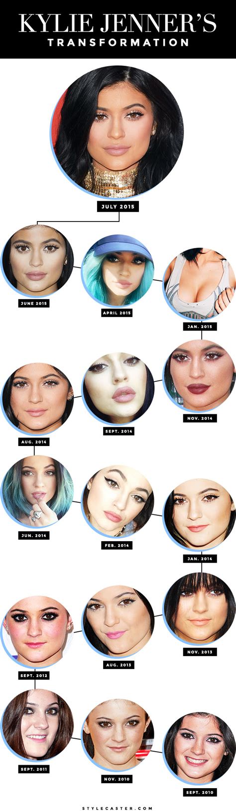 Kylie Jenner’s Beauty Evolution and Changing Face | StyleCaster