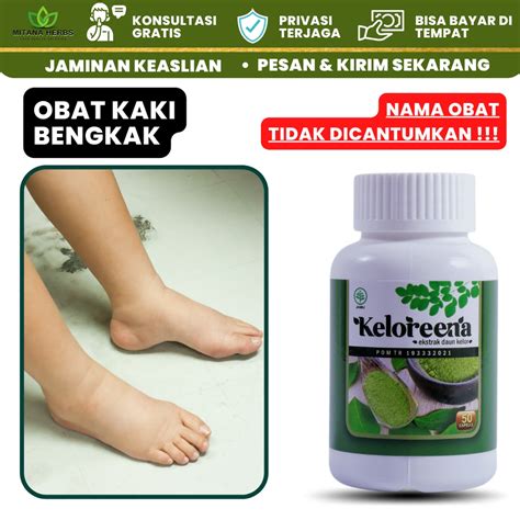 Jual Mitana Herbal Obat Kaki Bengkak Kaki Bengkak Asam Urat Kaki