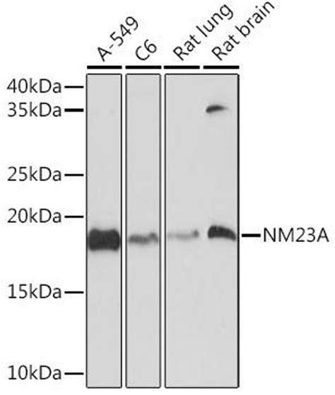 Anti Nm23a 抗体 Cab8802 Assay Genie