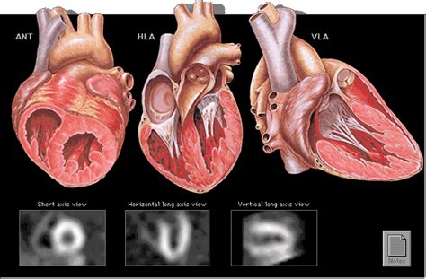 Book Nuclear Stress Test Dr Rudd Cardiology