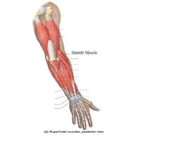 Lab 9 Images Only Muscles Of The Abdomen Arms Vertebral Column