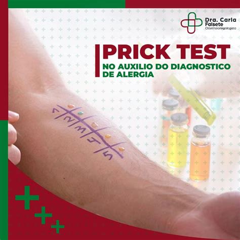 Prick Test Teste cutâneo de alergias