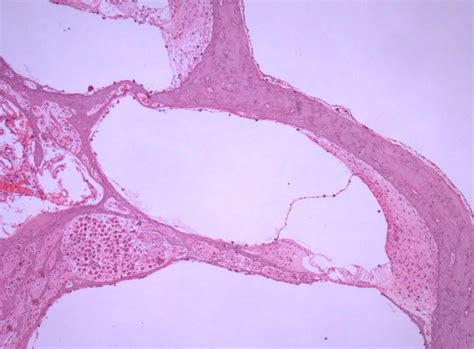 ear histology Diagram | Quizlet