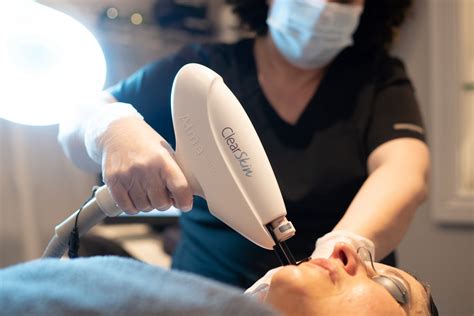 Clearskin™ Acne Laser Treatment Faqs Cosmetica London