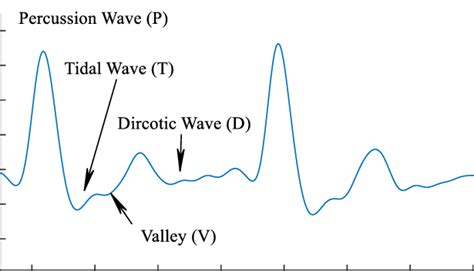 A sample pulse signal. | Download Scientific Diagram