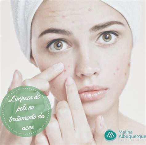 Limpeza De Pele No Tratamento Da Acne Dra Melina Albuquerque