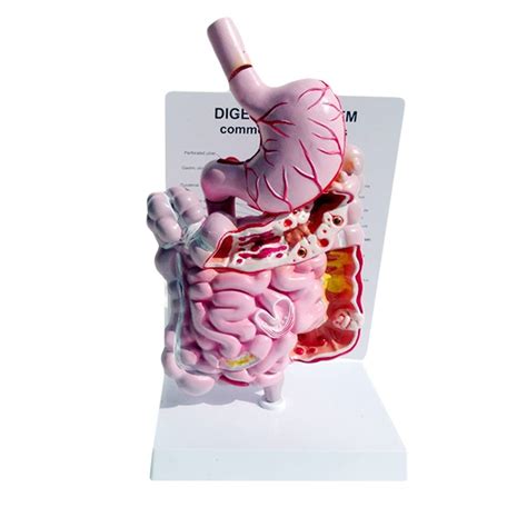 Buy Jujneanatomical Model Of Human Digestive System Model Of Large