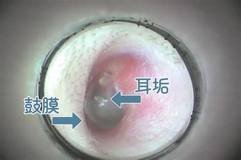 耳掃除のプロに教わる！ 正しい耳かきの方法＆耳周りのセルフケア となりのカインズさん