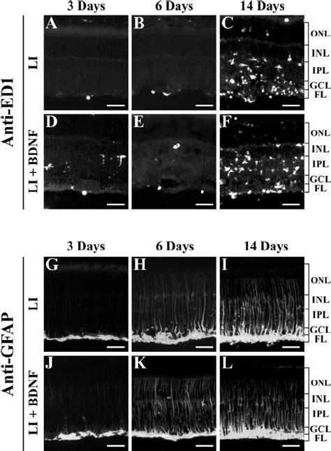 Bdnf Does Not Alter The Macrophage Or M Ller Cell Response Induced By