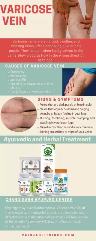 Ppt Understanding Varicose Veins Causes Symptoms And Treatment