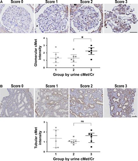 Cmet Intensity In The Kidney Tissue And Ucmet Cr Level A Glomerular