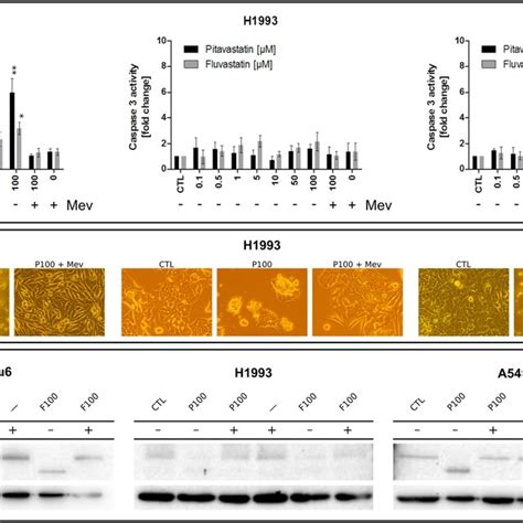 Statin Induced Apoptosis And Its Lipid Dependency In Nsclc Cells A