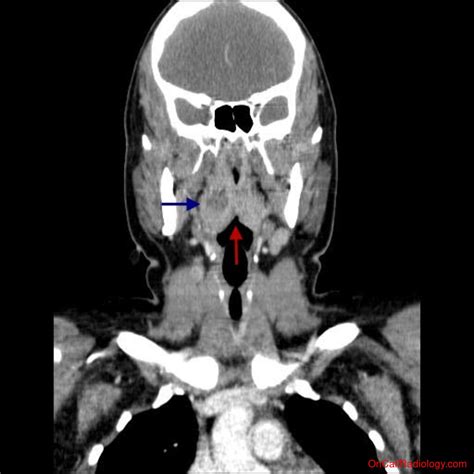 On Call Radiology Common Radiology Findings On Call And In The