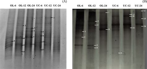 Polymerase Chain Reaction Denaturing Gradient Gel Electrophoresis Download Scientific Diagram