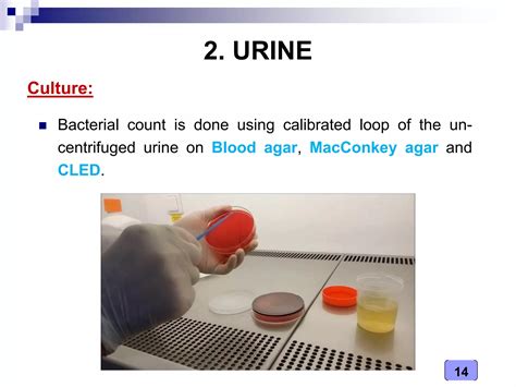 Medical Microbiology Laboratory Sample Collection Ppt