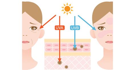 紫外線は皮膚にどういったダメージを与えるのか！？しっかりと理解し正しい紫外線対策を！