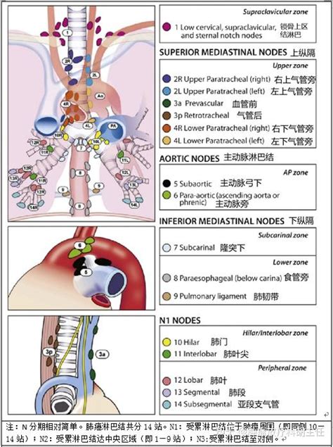 怎么确定肺癌的分期？ 知乎