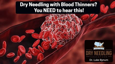 If You Needle Patients On Blood Thinners You Need To Hear This Youtube