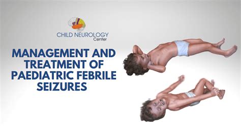 Management and Treatment of Paediatric Febrile Seizures - Child Neurology