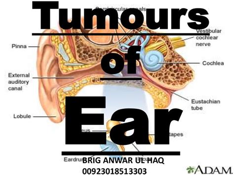 Tumours of Ear