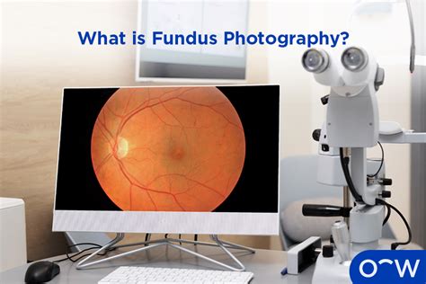 Oct Optical Coherence Tomography And Fundus Photography Test