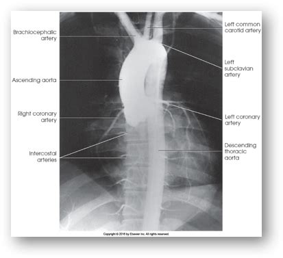 Ch Images Ir Cc And Vascular Flashcards Quizlet