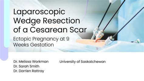 Laparoscopic Wedge Resection Of A Cesarean Scar Ectopic Pregnancy