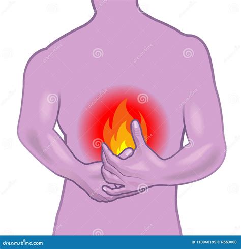 Burning Stomach Illustration Stock Vector Illustration Of Medical