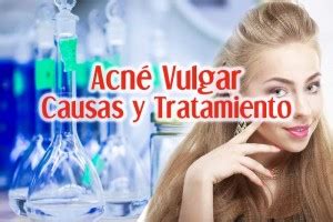 Acné Vulgar Causas Síntomas y Tratamiento