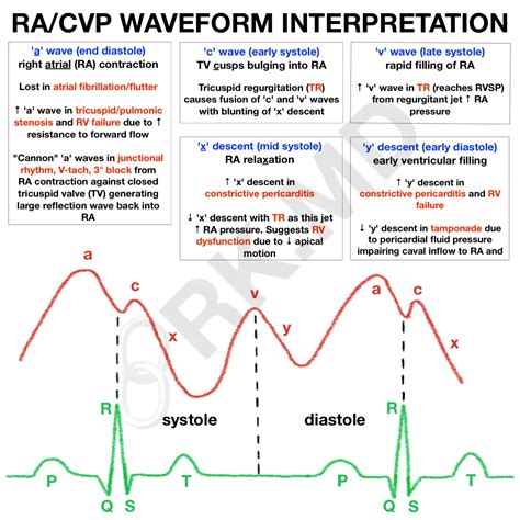 RA/CVP Waveform Interpretation | RK.MD