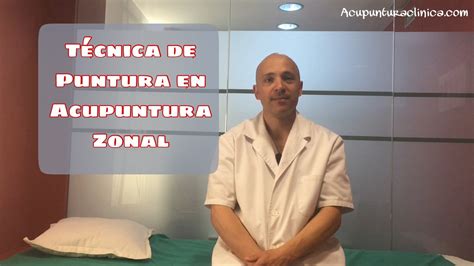 Técnica De Puntura En Acupuntura Zonal Youtube