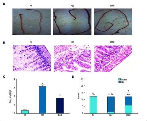 The Effect Of Irak Inhibitor On Intestinal Histopathology In A Neonatal