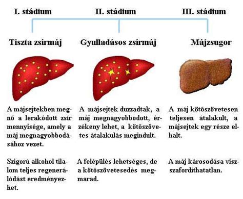 Májrák Milyen jelek esetén gondoljon bajra