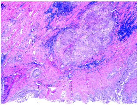 Low Power View ×4 Objective Lens Of Hematoxylin And Eosin H And E