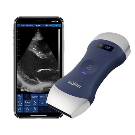 Eagleview Portable Wireless Ultrasound Scanner With Linear