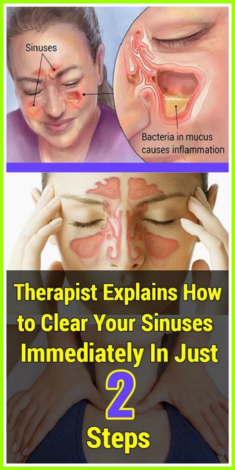 Heres How To Clear Your Sinuses Quickly In Just Two Steps How To