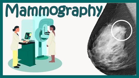 Mammography Test Mammogram For Breast Cancer What To Expect How