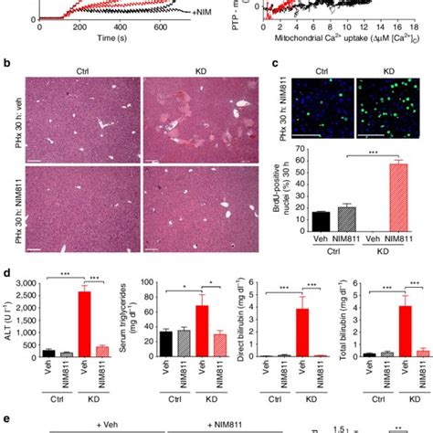 Liver Regeneration After Partial Hepatectomy Phx In Micu Kd And Ctrl