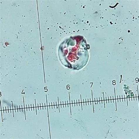 Entamoeba Histolytica Cyst Direct From Water 40x Download Scientific Diagram