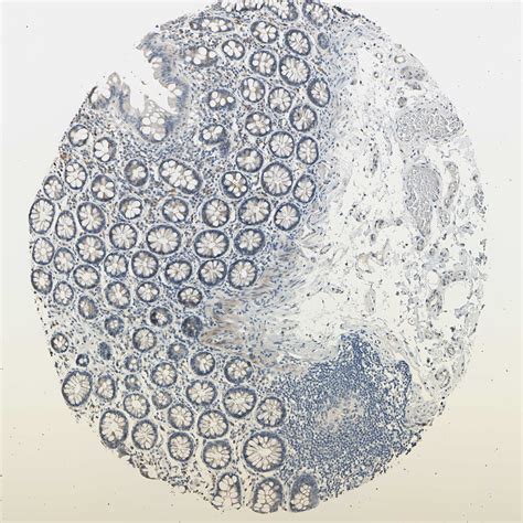 Tissue Expression Of Ldlr Staining In Colon The Human Protein Atlas