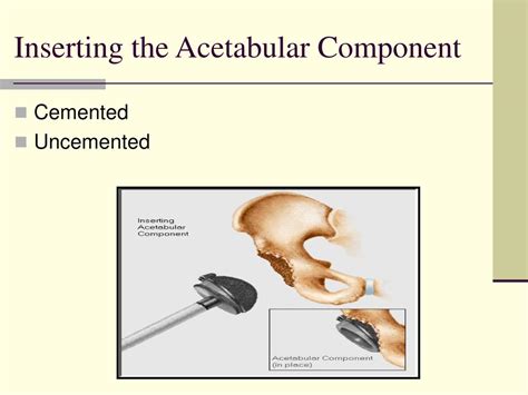 Ppt The Hip Joint Powerpoint Presentation Free Download Id1185674