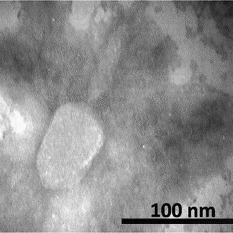 The Electron Micrograph Of Phage Vb Kpnm Teh The Scale Represents