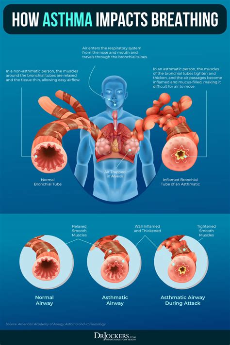 Asthma Symptoms Causes And Natural Support Strategies