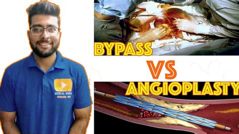 Angiography Angioplasty Vs Bypass Surgery Which One Is Better In Hindi Medical Guruji