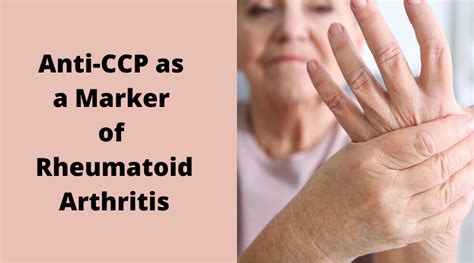 Anti CCP As A Marker Of Rheumatoid Arthritis