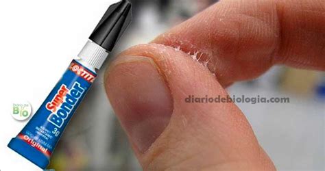 Como Tirar A Cola Super Bonder Da Pele Das Unhas E Dos Dentes