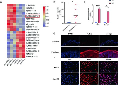 Gda Expression And Location A Differentially Expressed Lncrnas In