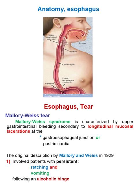 Esophagus, Tear | Esophagus | Stomach