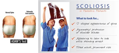 Scoliosis Exam For Precision Skoliosis Treatment In KL